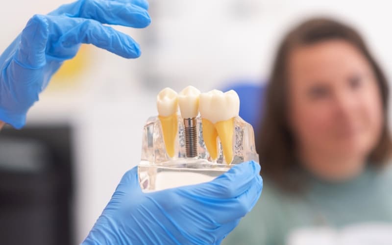 A gloved hand holding a dental implant model, with a patient looking on in the background