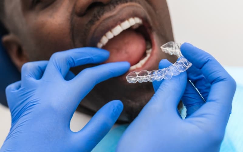A clinician fitting a clear aligner to a patient's teeth