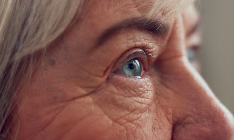 A close-up of the skin around an older patient's eye before facial treatment