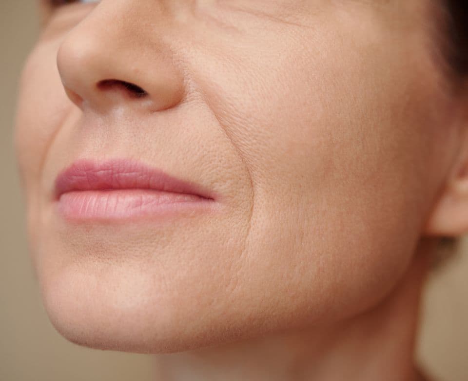 A close-up of the lower face showing fine lines around the mouth and jaw
